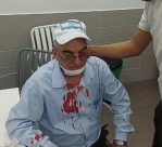 اللد: اصابة سائق حافلة بجروح اثر القاء زجاجة فارغة 